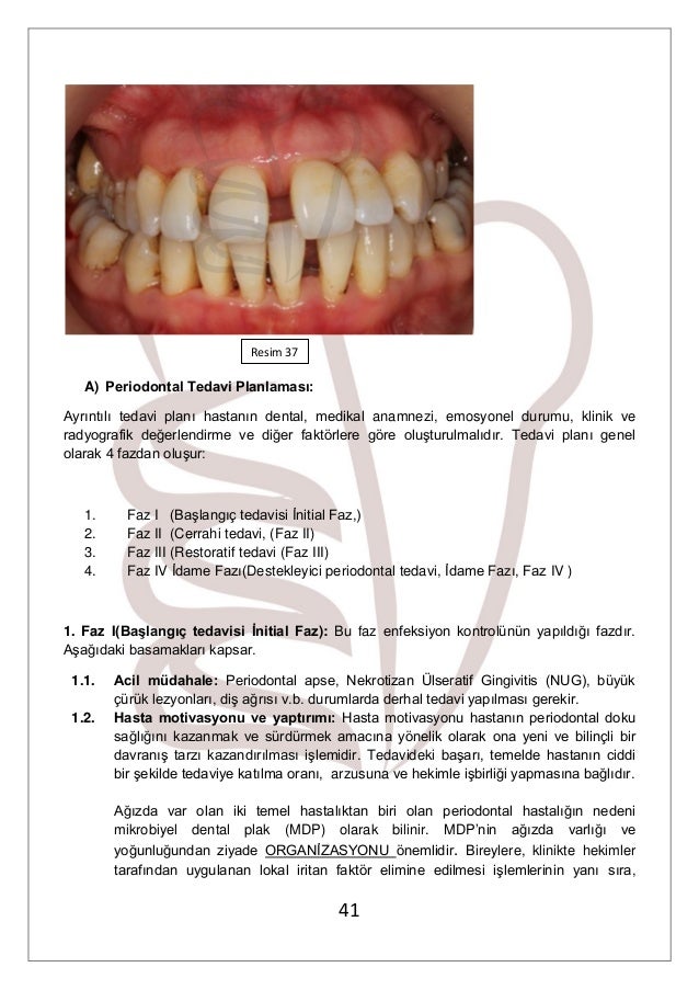 Dişlerin periodontitis - ne oldu Bebeklerin periodontitisleri: sebepler, semptomlar ve tedavi özellikleri 53